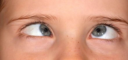Augenfehlstellung Sehgleichgewicht Fehlstellung Augen Optik Weißmann Oberaudorf Schielen Gleichgewicht Heterophorie