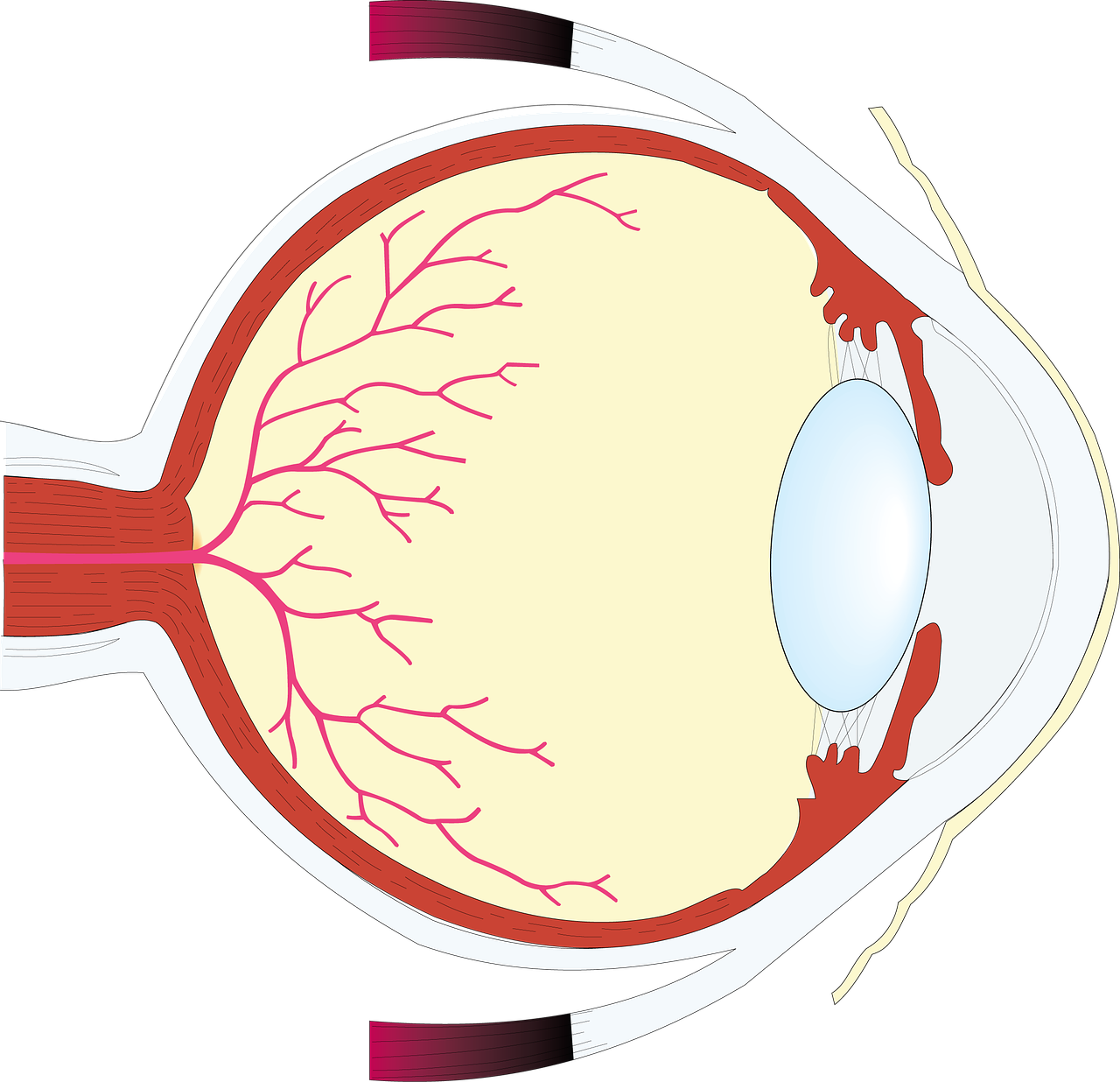 Grauer Star Katarakt schleierhaft verschwommen Augenerkrankung Erblindung Optik Weißmann Oberaudorf Brillen Auge Alterstar Sehbeeinträchtigung Krankheit Retina